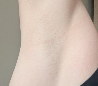 After 6 sessions