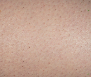 Real Results — Before & After - After