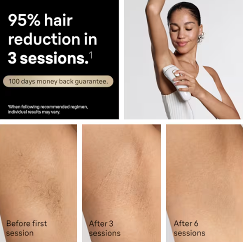 GLACÉA™ IPL Élégance 4in1 | Limited