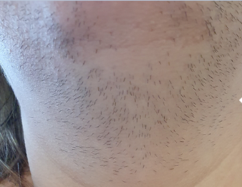 Real Results — Before & After - Before