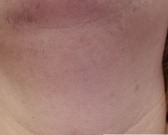 Real Results — Before & After - After
