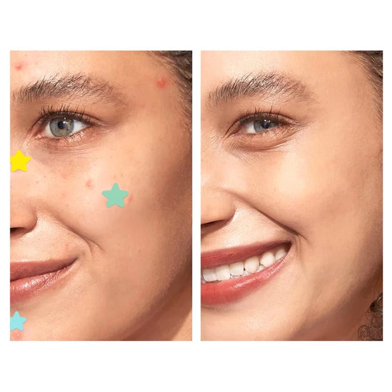 ClearShield™ Acne Patch