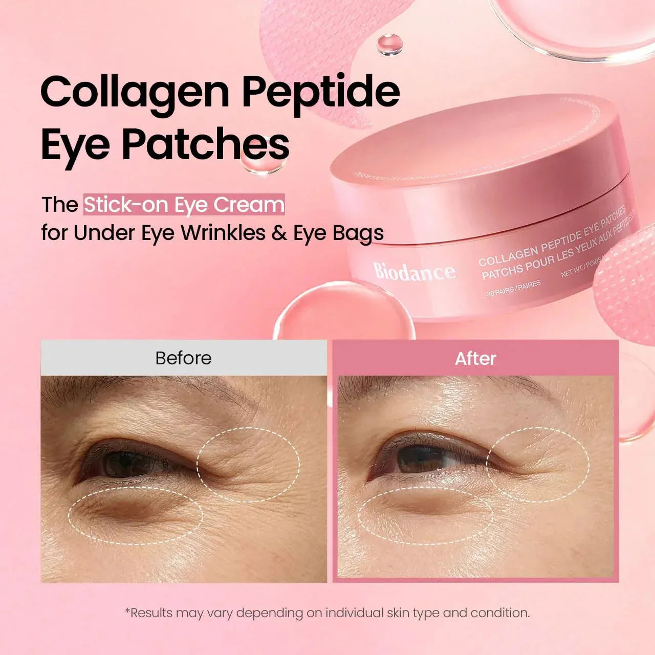 Diamond-Gel Collagen Peptide Eye Patches - LUMOAUR